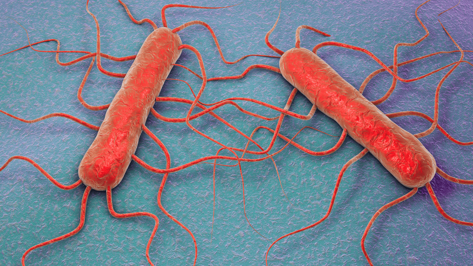 Listeria monocytogenes: La bacteria invisible que exige máximo control en la industria alimentaria